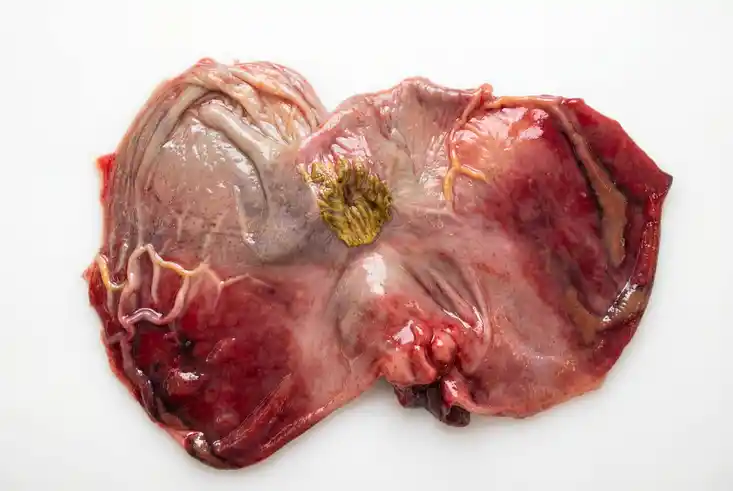 Blutige Magenschleimhaut bei Schweinepest