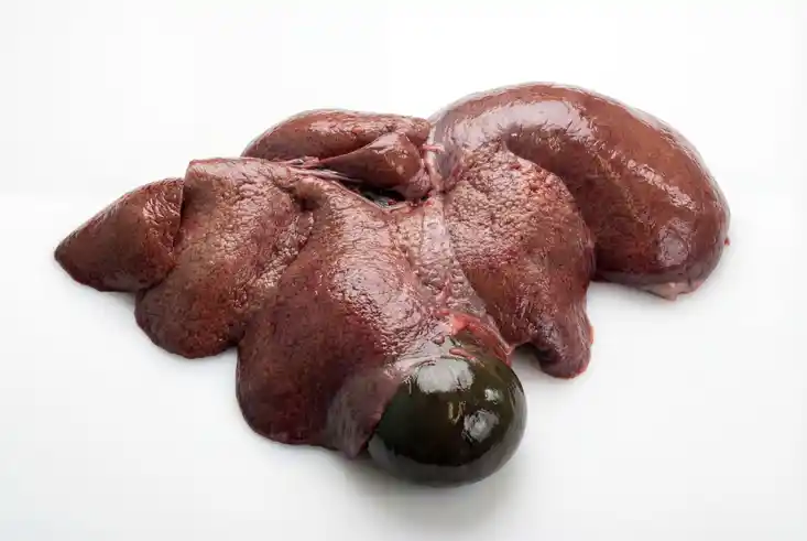 Leberzirrrhose Biber