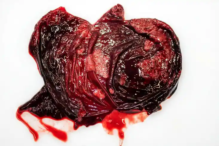 Bedenkliche Merkmale Harnblase Feldhase